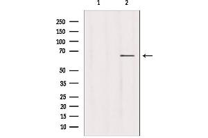 Western blot analysis of extracts from hepg2, using USP39 antibody. (USP39 Antikörper  (N-Term))