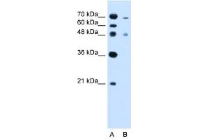 ZFYVE27 antibody used at 2. (ZFYVE27 Antikörper  (C-Term))