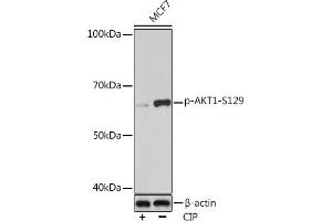 Western blot analysis of extracts of MCF7 cells, using Phospho--S129 Rabbit mAb (ABIN7271246) at 1:1000 dilution. (AKT1 Antikörper  (pSer129))