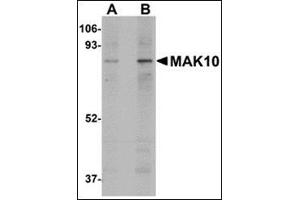 Western blot analysis of MAK10 in mouse heart tissue lysate with this product at (A) 1 and (B) 2 μg/ml.