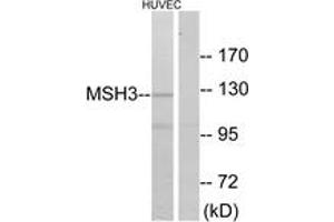 Western blot analysis of extracts from HuvEc cells, using MSH3 Antibody.