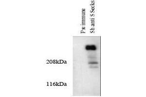 Western blotting total cellular protein from cultured rat aortic smooth muscle cells was prepared and analyze. (AKAP12 Antikörper)