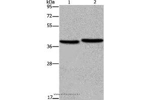 Western blot analysis of MCF-7 and NIH/3T3 cell, using FHL1 Polyclonal Antibody at dilution of 1:400 (FHL1 Antikörper)