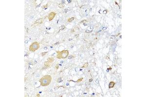 Immunohistochemistry of paraffin-embedded rat brain using CALHM1 antibody at dilution of 1:100 (x40 lens).