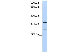KCNIP2 Antikörper  (N-Term)