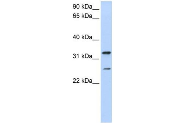 KCNIP2 Antikörper  (N-Term)