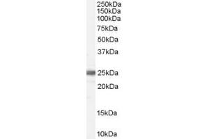 Western Blotting (WB) image for anti-Branched Chain Keto Acid Dehydrogenase E1, beta Polypeptide (BCKDHB) (N-Term) antibody (ABIN2787755) (BCKDHB Antikörper  (N-Term))