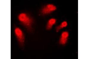 Immunofluorescent analysis of AIRE staining in Jurkat cells. (AIRE Antikörper  (Center))