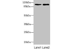 Western blot All lanes: GRIK3 antibody at 1. (GRIK3 Antikörper  (AA 32-240))
