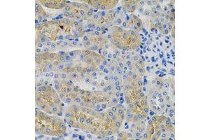 Immunohistochemistry of paraffin-embedded mouse kidney using ANGPTL3 Antibody (ABIN5970263) at dilution of 1/100 (40x lens). (ANGPTL3 Antikörper)