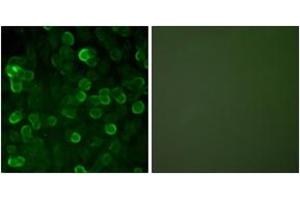 Immunofluorescence (IF) image for anti-Cadherin 1, Type 1, E-Cadherin (Epithelial) (CDH1) (AA 1-50) antibody (ABIN1533229)