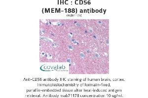 Image no. 1 for anti-Neural Cell Adhesion Molecule 1 (NCAM1) antibody (ABIN1724016) (CD56 Antikörper)