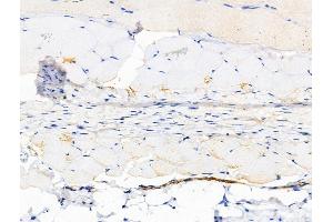 ABIN6260017 and ABIN6266498 at 1/100 staining Mouse skin tissue by IHC-P.