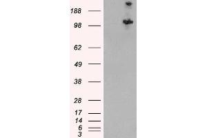 HEK293 overexpressing Human TSC1 and probed with ABIN2562994 (mock transfection in first lane). (TSC1 Antikörper  (C-Term, Isoform 1))