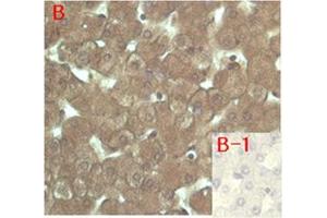 Immunohistochemical staining of human tissue using anti-FGF-23 (human), mAb (FG322-3)  at 1:200 dilution. (FGF23 Antikörper)