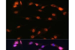 Immunofluorescence analysis of C6 cells using ALOX5 Polyclonal Antibody at dilution of 1:100. (ALOX5 Antikörper)