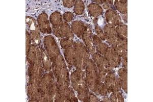 Immunohistochemical staining of human stomach with RCCD1 polyclonal antibody  shows distinct cytoplasmic and nuclear positivity in glandular cells at 1:50-1:200 dilution. (RCCD1 Antikörper)