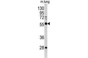 Western blot analysis of FLI1 antibody (Center) in mouse lung tissue lysates(35 µg/lane).