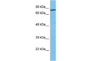 Host:  Rabbit  Target Name:  FOXM1  Sample Tissue:  Human 786-0 Whole Cell  Antibody Dilution:  1ug/ml (FOXM1 Antikörper  (Middle Region))