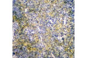 IHC analysis of MPI using anti-MPI antibody (ABIN4886672). (MPI Antikörper  (AA 2-99))