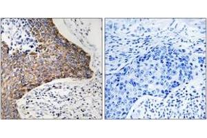 Immunohistochemistry analysis of paraffin-embedded human tonsil tissue, using C1QBP Antibody. (C1QBP Antikörper  (AA 61-110))