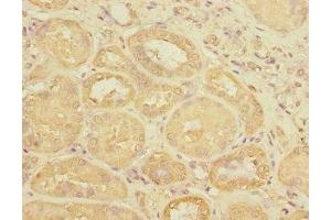Immunohistochemistry of paraffin-embedded human kidney tissue using ABIN7175143 at dilution of 1:100 (Uroplakin 3A Antikörper  (AA 19-207))