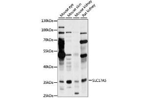 Western blot analysis of extracts of various cell lines, using SLC17A5 antibody (ABIN6294219) at 1:1000 dilution. (Solute Carrier Family 17 (Acidic Sugar Transporter), Member 5 (SLC17A5) Antikörper)