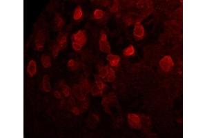 Immunofluorescence (IF) image for anti-Sarcolemma Associated Protein (SLMAP) (N-Term) antibody (ABIN7273079) (SLMAP Antikörper  (N-Term))