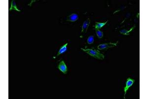 Immunofluorescent analysis of Hela cells using ABIN7143907 at dilution of 1:100 and Alexa Fluor 488-congugated AffiniPure Goat Anti-Rabbit IgG(H+L) (AMACR Antikörper  (AA 13-175))