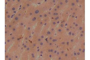 IHC-P analysis of Human Liver Tissue, with DAB staining. (BMP1 Antikörper  (AA 610-843))