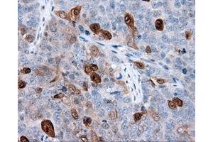 Immunohistochemical staining of paraffin-embedded Kidney tissue using anti-ANXA1 mouse monoclonal antibody. (Annexin a1 Antikörper)