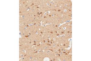 Immunohistochemical analysis of paraffin-embedded Human brain tissue using A performed on the Leica® BOND RXm.