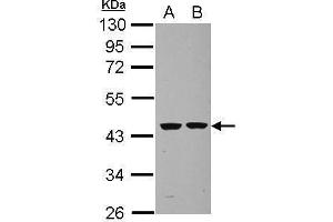 WB Image Sample (30 ug of whole cell lysate) A: U87-MG B: SK-N-SH 10% SDS PAGE antibody diluted at 1:1000 (Septin 2 Antikörper)