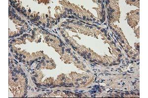 Image no. 1 for anti-Acyl-CoA Thioesterase 12 (ACOT12) antibody (ABIN1496415) (ACOT12 Antikörper)