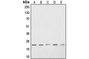 Western blot analysis of CSRP1 expression in Jurkat (A), HeLa (B), PC3 (C), DU145 (D), A10 (E) whole cell lysates. (CSRP1 Antikörper  (Center))
