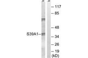 Western blot analysis of extracts from Jurkat cells, using SLC39A1 Antibody.