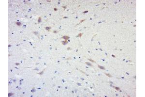 Paraformaldehyde-fixed, paraffin embedded rat brain, Antigen retrieval by boiling in sodium citrate buffer (pH6) for 15min, Block endogenous peroxidase by 3% hydrogen peroxide for 30 minutes, Blocking buffer (normal goat serum) at 37°C for 20min, Antibody incubation with RPS6KB1(Ser441+Thr444) Antibody, Unconjugated  at 1:200 overnight at 4°C, followed by a conjugated secondary and DAB staining.