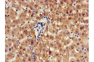 Immunohistochemistry of paraffin-embedded human liver tissue using ABIN7144062 at dilution of 1:100 (ZFAND6 Antikörper  (AA 1-208))