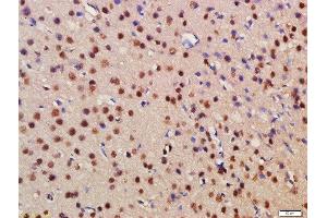 Formalin-fixed and paraffin embedded rat brain labeled with Rabbit Anti-BRD1 Polyclonal Antibody, Unconjugated (ABIN1387435) at 1:200 followed by conjugation to the secondary antibody and DAB staining (BRD1 Antikörper  (AA 701-800))
