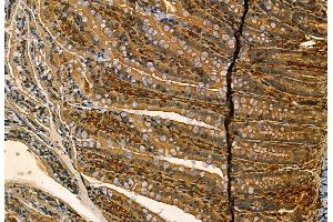 ABIN6263289 and ABIN6268776 at 1/100 staining Rat colon tissue by IHC-P.