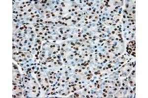 Immunohistochemical staining of paraffin-embedded liver tissue using anti-ERCC1 mouse monoclonal antibody. (ERCC1 Antikörper)