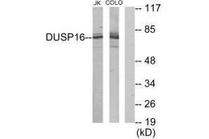 Western blot analysis of extracts from Jurkat cells and COLO205 cells, using DUSP16 antibody. (DUSP16 Antikörper)