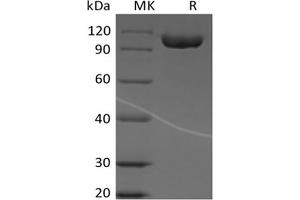 Western Blotting (WB) image for Immunoglobulin Superfamily, Member 8 (IGSF8) protein (Fc Tag) (ABIN7319850) (IGSF8 Protein (Fc Tag))