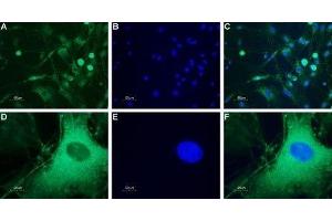 Expression of neuropeptide Y5 receptor in rat DRG - Immunocytochemical staining of a primary culture of rat dorsal root ganglion (DRG) neurons. (NPY5R Antikörper  (AA 291-306))