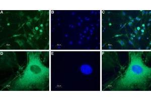 Expression of neuropeptide Y5 receptor in rat DRG - Immunocytochemical staining of a primary culture of rat dorsal root ganglion (DRG) neurons. (NPY5R Antikörper  (3rd Intracellular Loop))