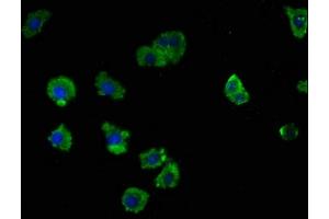 Immunofluorescence staining of HepG2 cells with ABIN7158062 at 1:100, counter-stained with DAPI. (LRTM2 Antikörper  (AA 36-310))