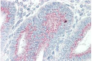 Human Uterus (formalin-fixed, paraffin-embedded) stained with ORAI3 antibody ABIN337113 at 5 ug/ml followed by biotinylated goat anti-rabbit IgG secondary antibody ABIN481713, alkaline phosphatase-streptavidin and chromogen. (ORAI3 Antikörper  (N-Term))