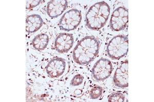 Immunohistochemistry of paraffin-embedded human colon using S100 antibody (ABIN7270126) at dilution of 1:100 (40x lens).