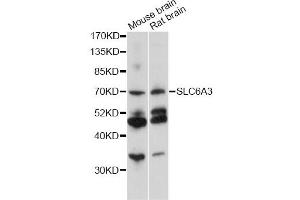 Western blot analysis of extracts of various cell lines, using SLC6A3 antibody (ABIN6291471) at 1:1000 dilution. (SLC6A3 Antikörper)