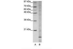Image no. 1 for anti-Apolipoprotein O (APOO) (N-Term) antibody (ABIN202054) (APOO Antikörper  (N-Term))